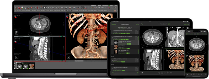 Software, die die Visage App anzeigt, mit der Radiolog:innen große Diagnosedateien interpretieren.